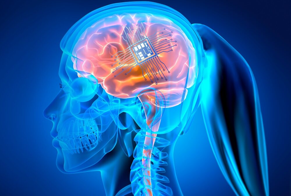 BDNF And Stroke Recovery
