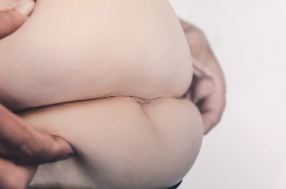 Pelvic Organ Prolapse: What You Need To Know