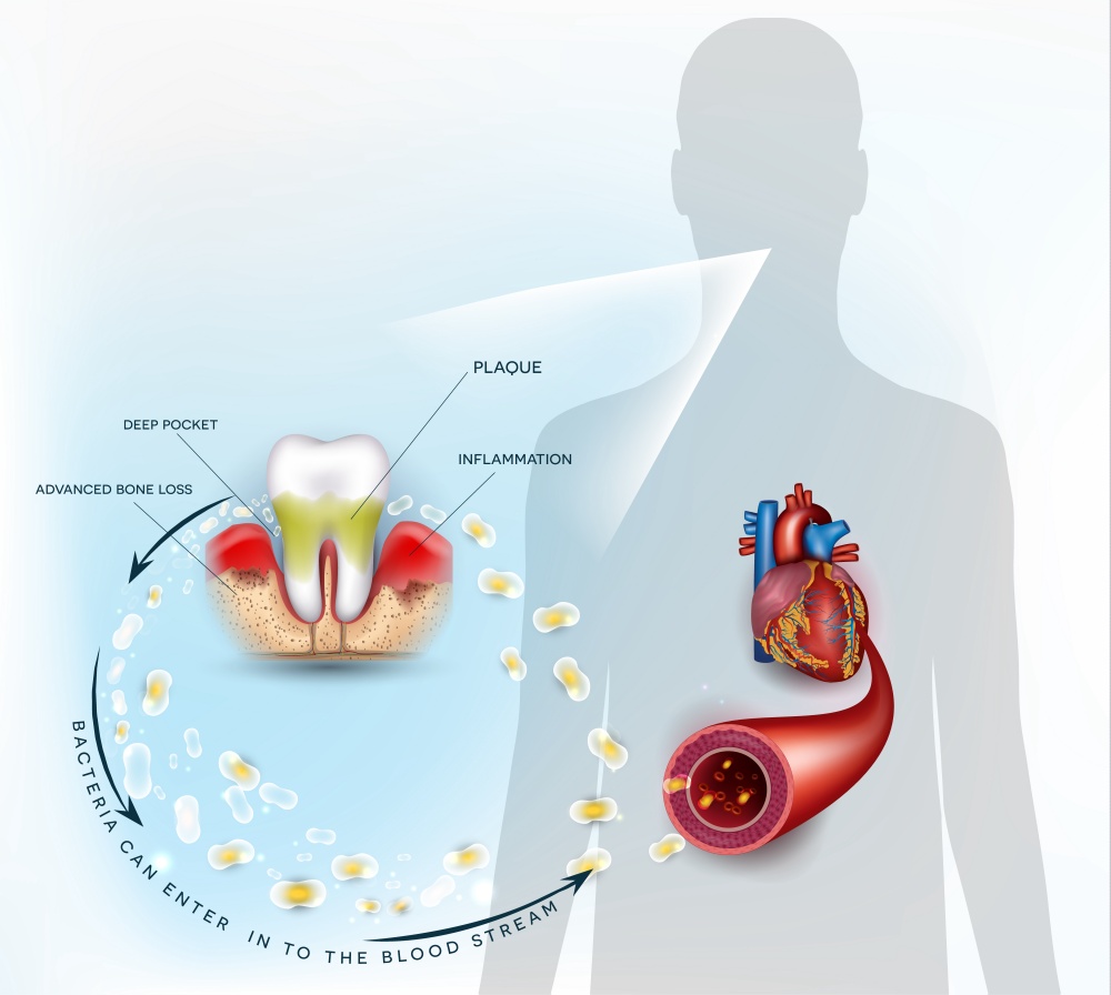oral health and heart health