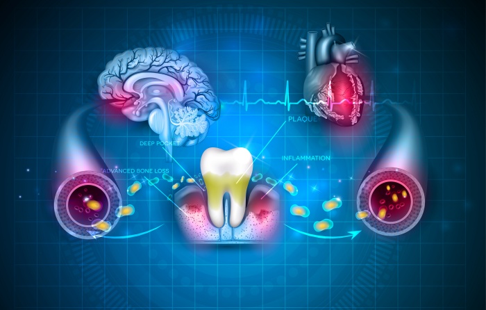 oral health and heart disease